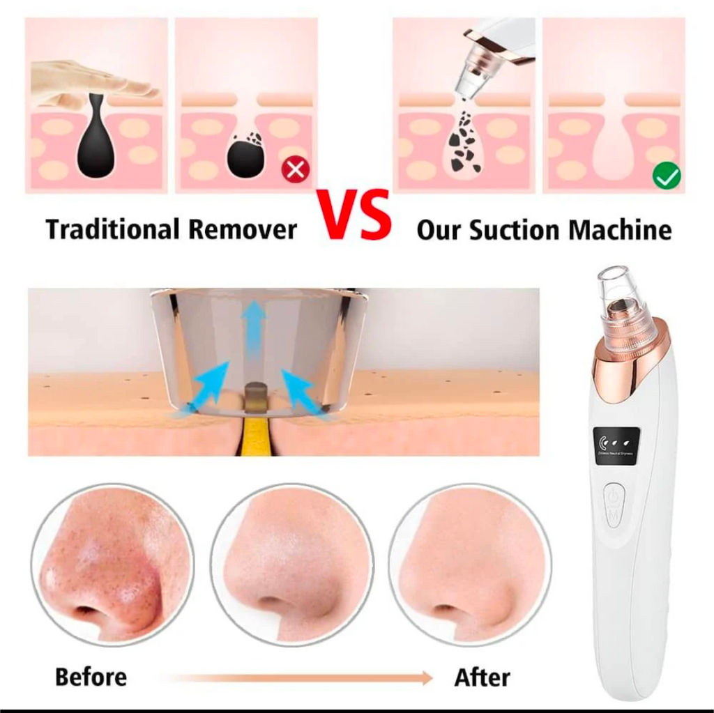 5in1 Blackhead Remover Machine Rechargeable | Face Vacuum Derma Suction With 5 Heads | Blackhead Removing Machine